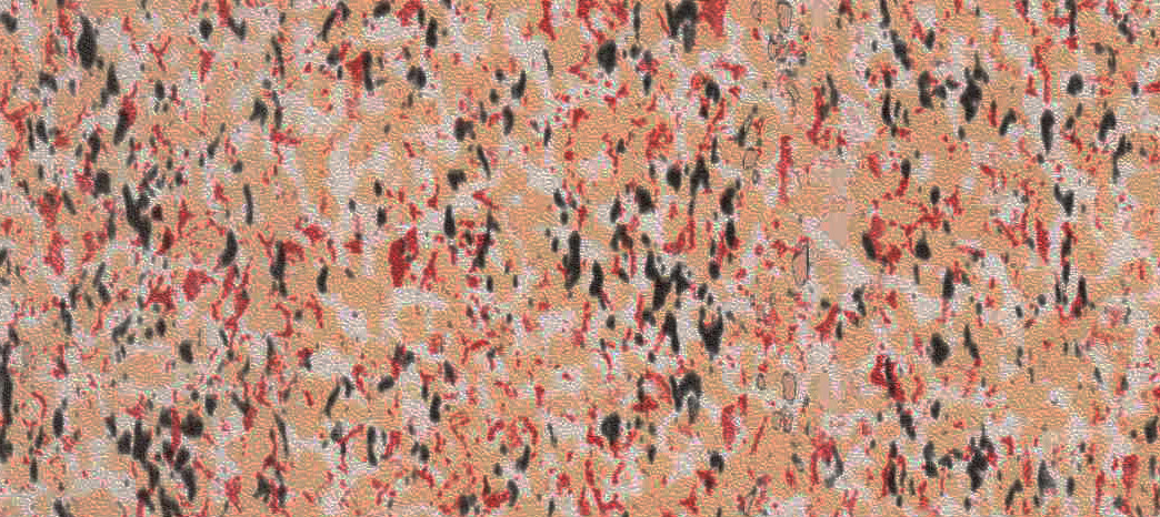 CORAL-SAND